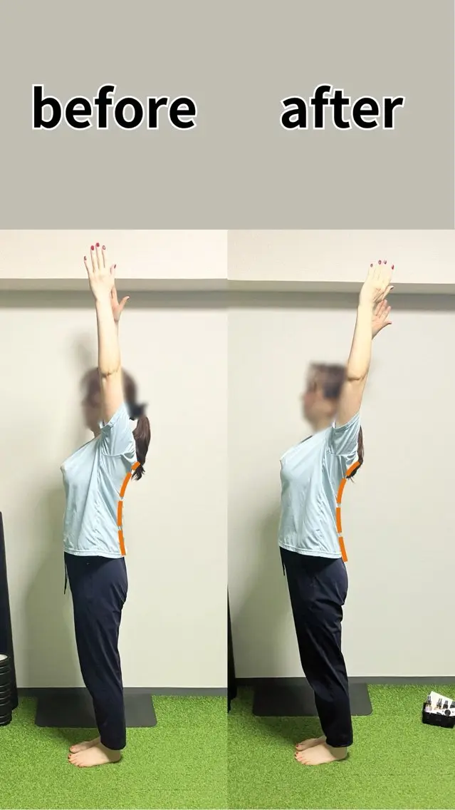 SLC  MOVE 整体×トレーニングのエステ・リラクイメージ