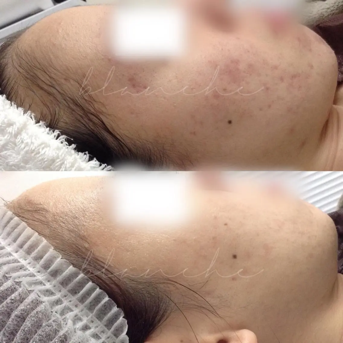 ミディアム カラー パーマ ヘアアレンジ ネイル マツエク・マツパ アイブロウ エステ リラク 都度払い肌質改善 &脱毛Blancheのエステ・リラクイメージ