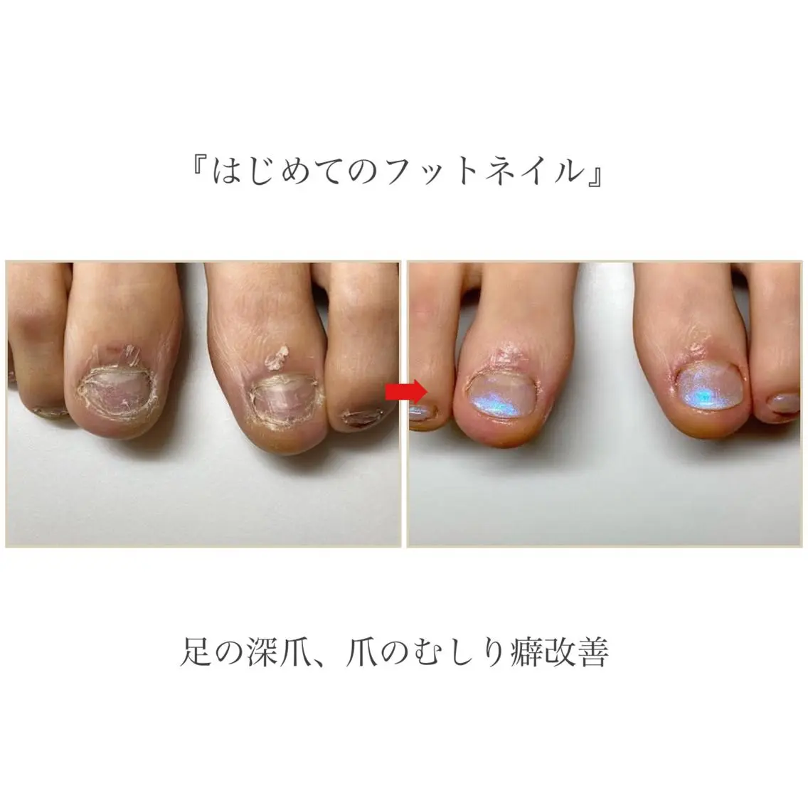 ネイル フットネイル ネイルサロン アリュームのネイルデザイン