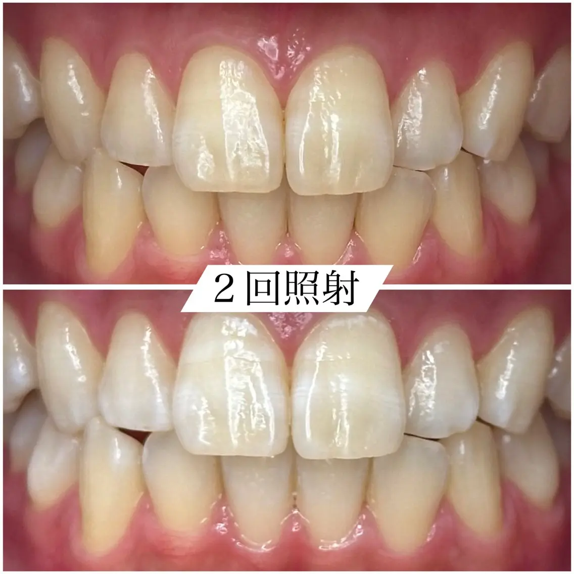その他 White base ホワイトニングサロンのその他イメージ
