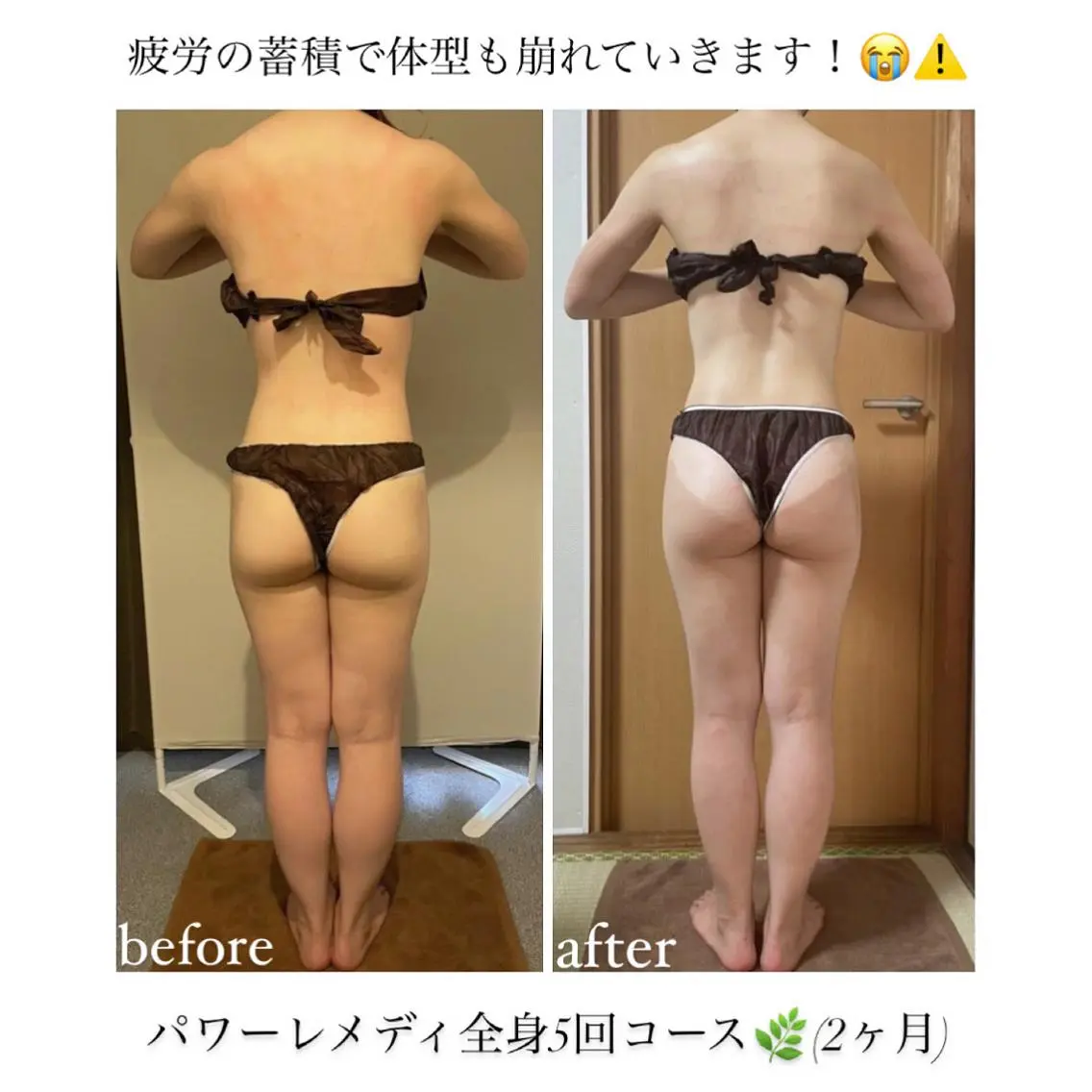 《本気痩せ×疲労改善 》  BILOOPのエステ・リラクイメージ