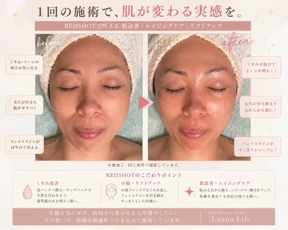 肌改善・脱毛・痩身 LuanaLifeのエステ・リラクイメージ