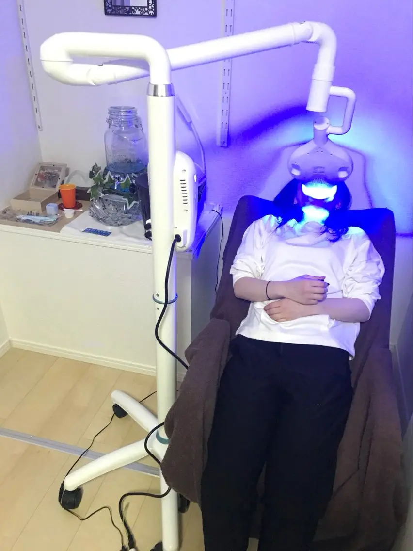 目指せ白い歯❗セルフホワイトニング🦷✨2回目以降のお客様!!!!の写真