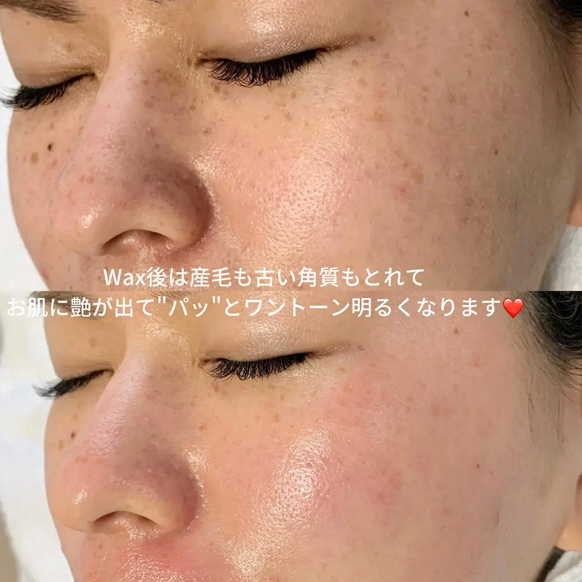 メンズ 脱毛 稲嶺 美華のエステ・リラクイメージ