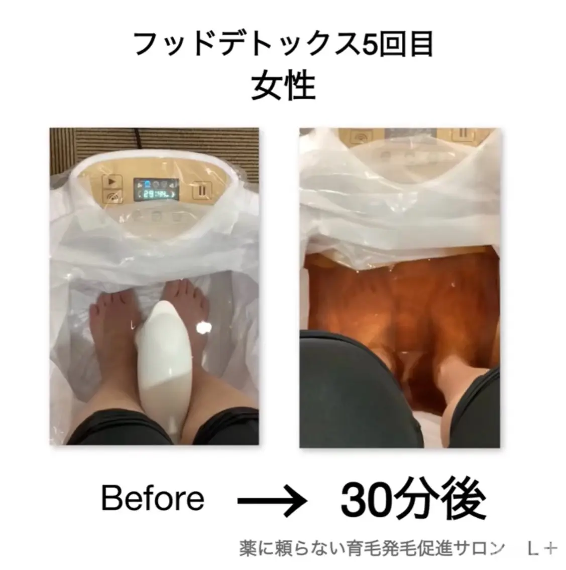 L+ 育毛発毛サロン秋葉原のエステ・リラクイメージ