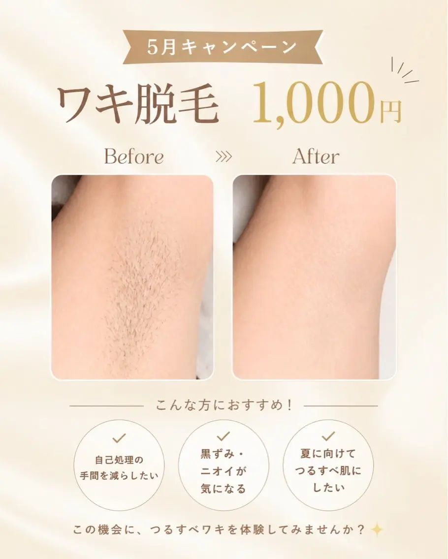 5月限定キャンペーン✨ワキ脱毛1回¥1,000‼️の写真