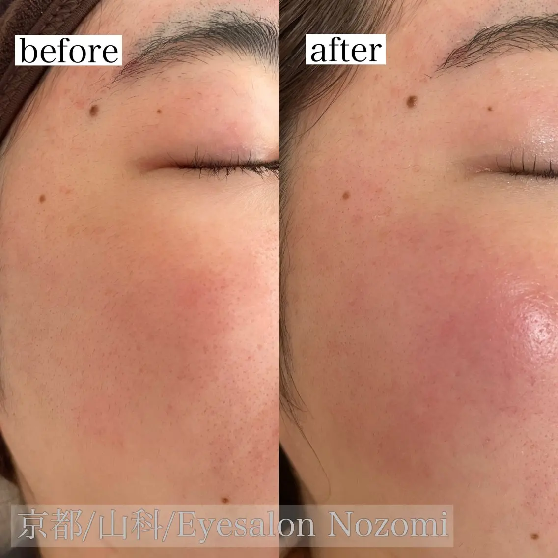 Eyesalon Nozomiのマツエク・マツパデザイン