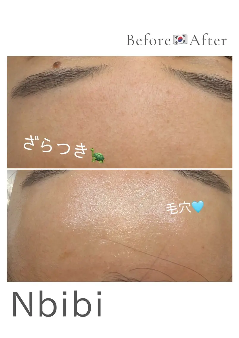 エステ 韓国🇰🇷価格 サロン_Nbibiの眉毛・アイブロウイメージ