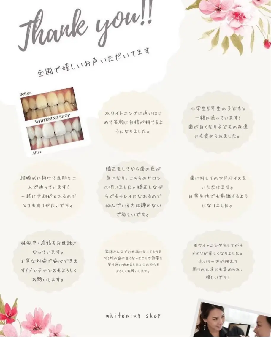 ホワイトニング ショップ伊丹店のその他イメージ
