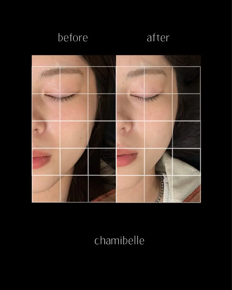 美容鍼灸サロン Chamibelleのエステ・リラクイメージ