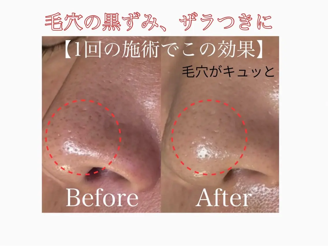 六本木脱毛andS 店長Sachiのエステ・リラクイメージ