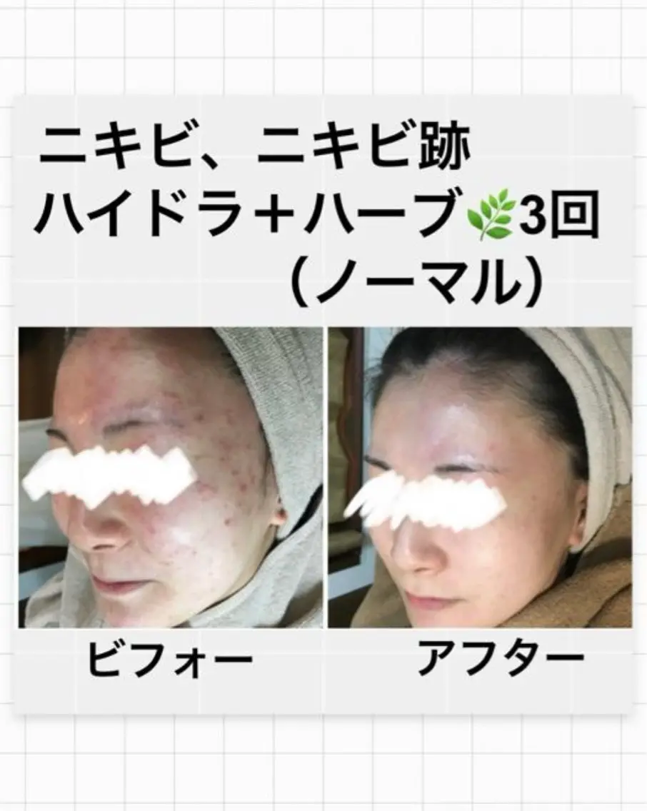 ハーブピーリング専門 MOKAのエステ・リラクイメージ