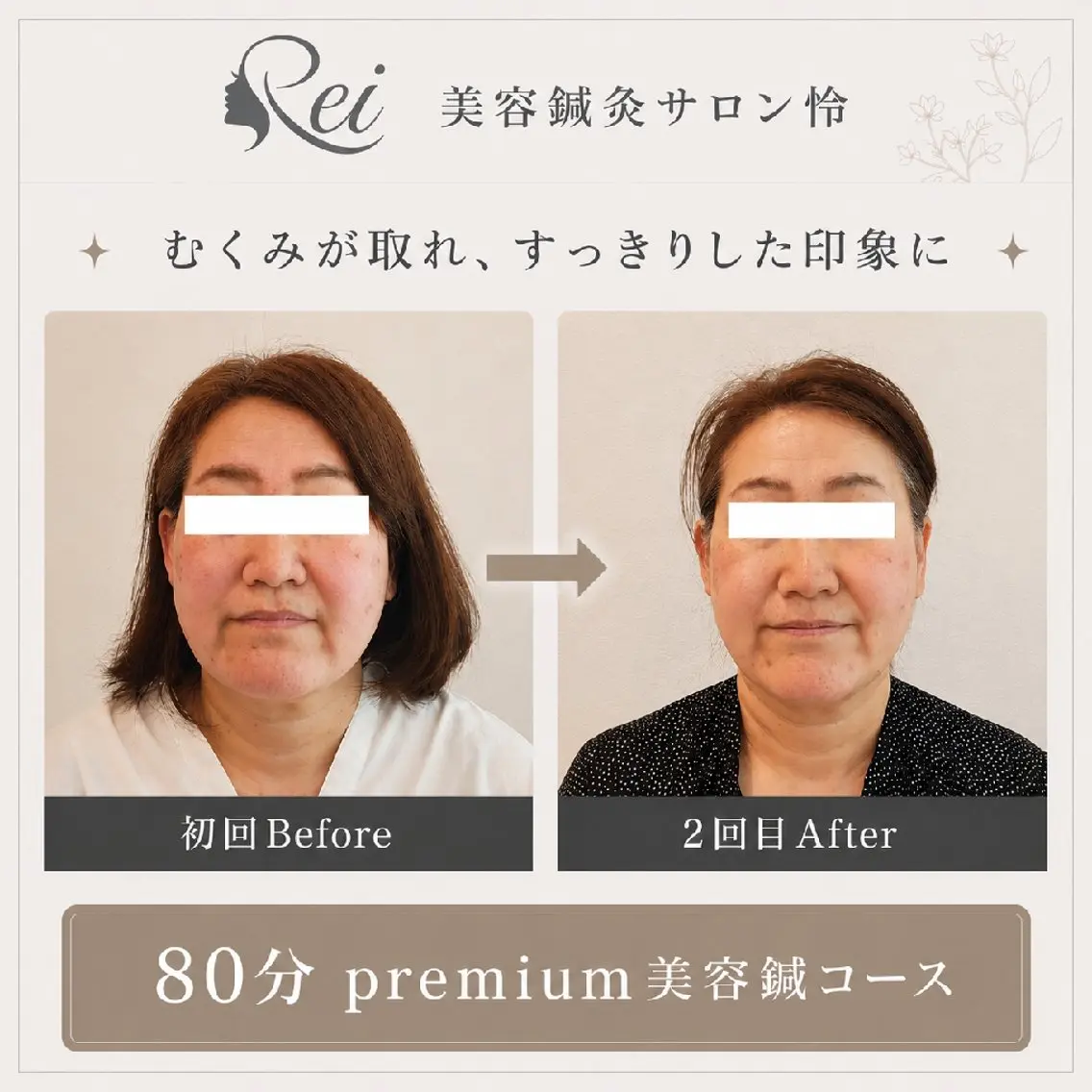エステ リラク 美容鍼灸サロン怜 -Rei-のエステ・リラクイメージ