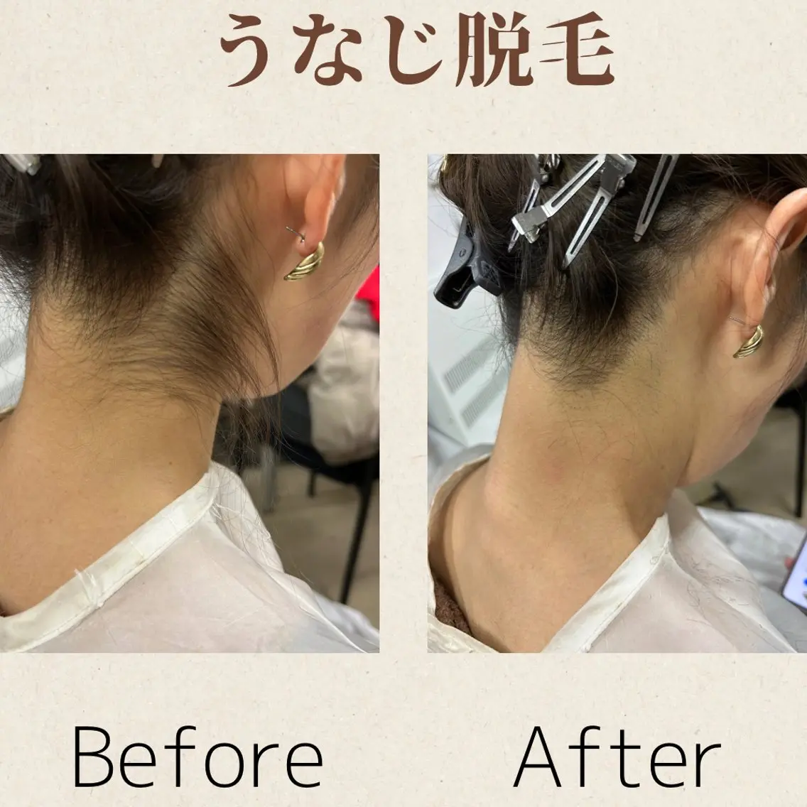 脱毛 MODE K's 白石彩夏のエステ・リラクイメージ