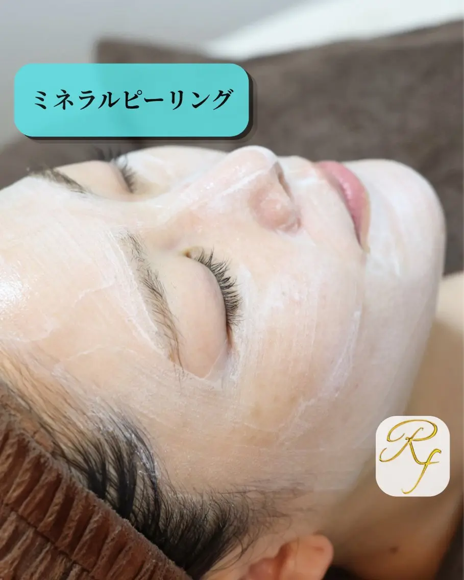 【ミネラルピーリング💎】剥離なし ニキビや毛穴悩みにアプローチ!「肌若いね」と褒められる、ハリに満ちた滑らか美素肌へ✨の写真