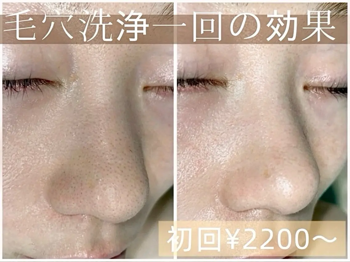 エステ Bell Miu🩵 mayuyuのエステ・リラクイメージ