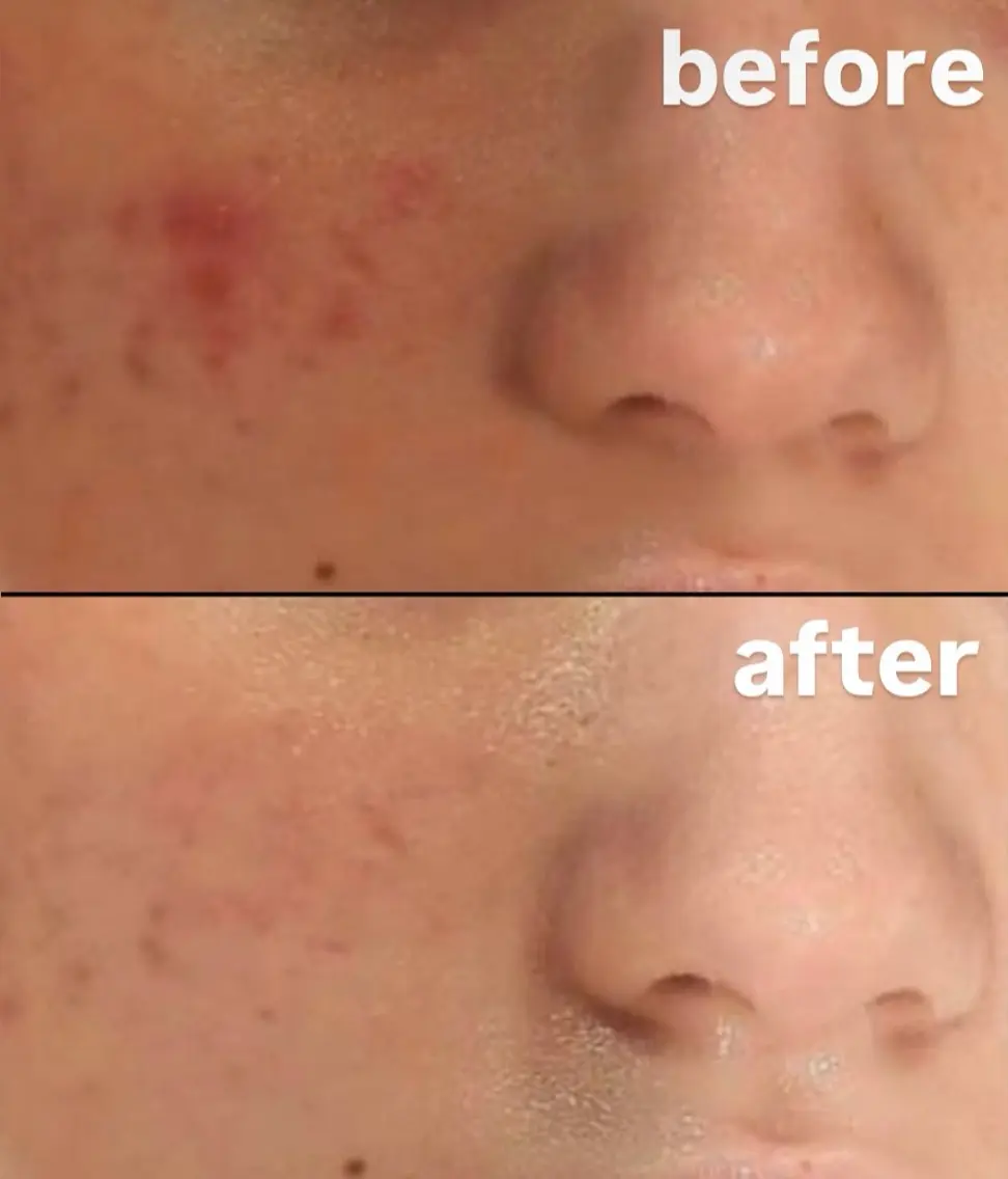 エステ esthesalon O'-en-のエステ・リラクイメージ