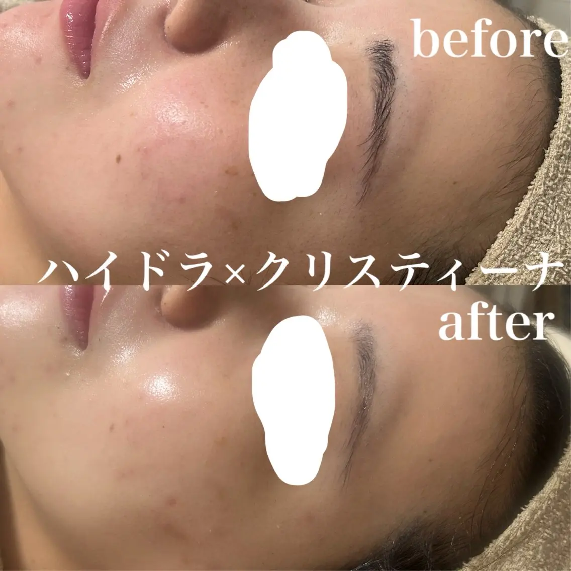 エステ フェイシャルサロン CHIARA 荒田のエステ・リラクイメージ