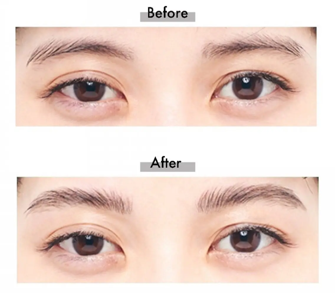 美眉矯正＋眉毛wax脱毛の写真