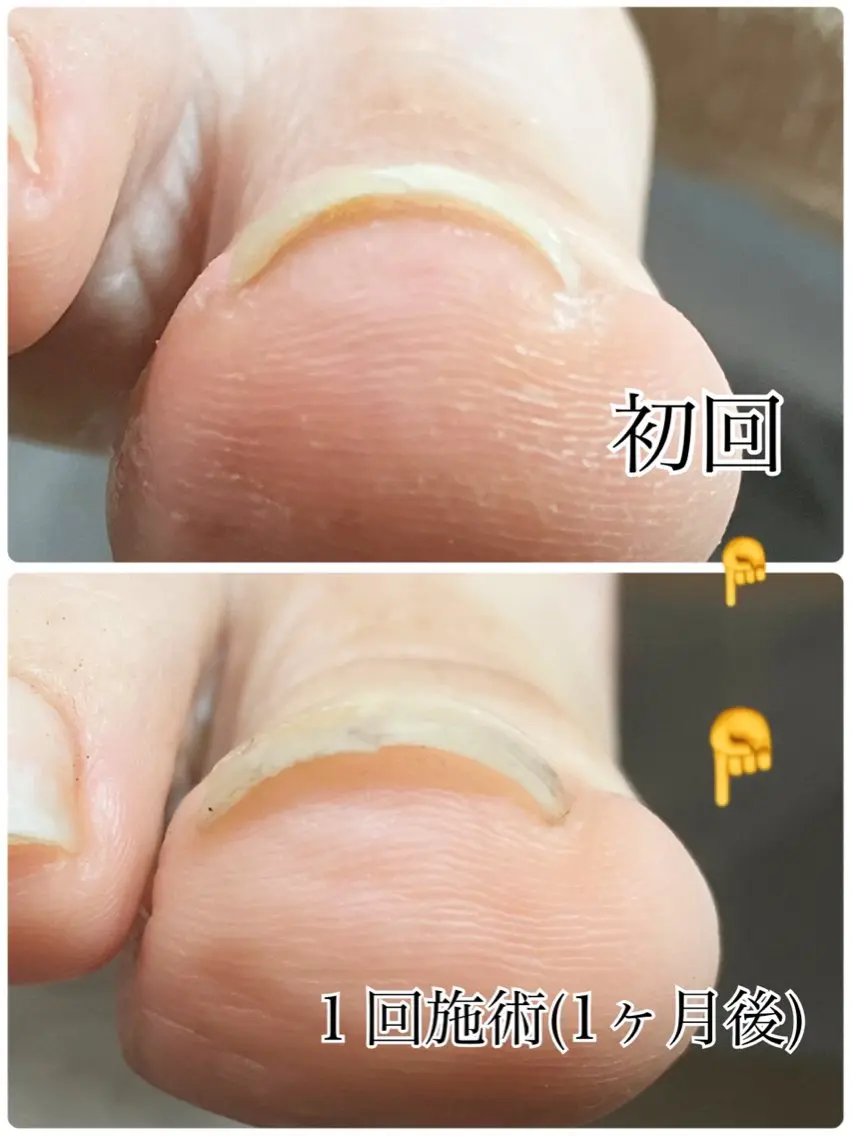 BellaLuna NAILのネイルデザイン