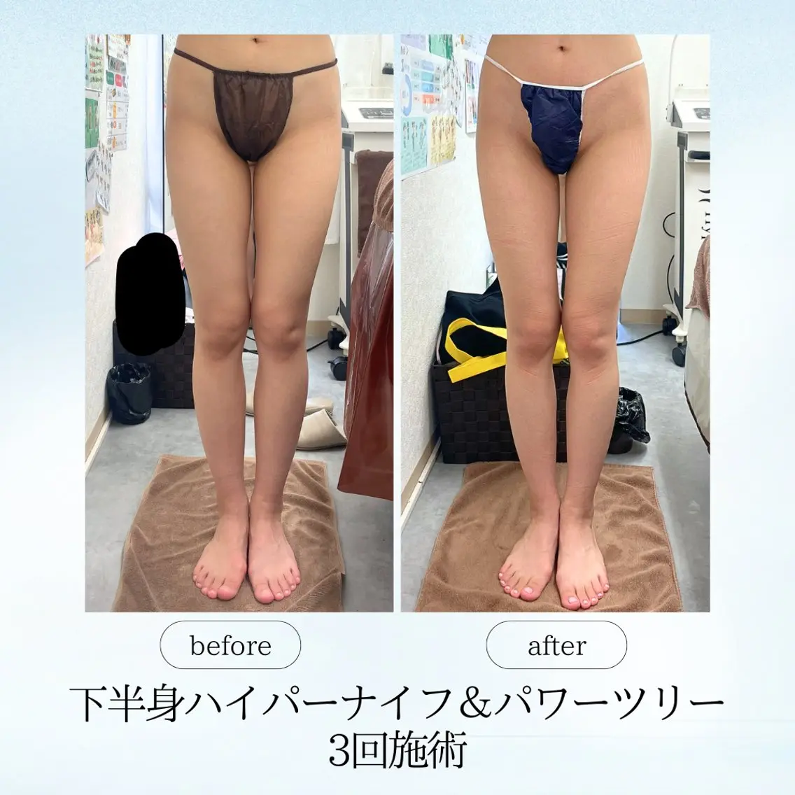 エステ リラク 《痩身、小顔専門店》 エスプレッソのエステ・リラクイメージ