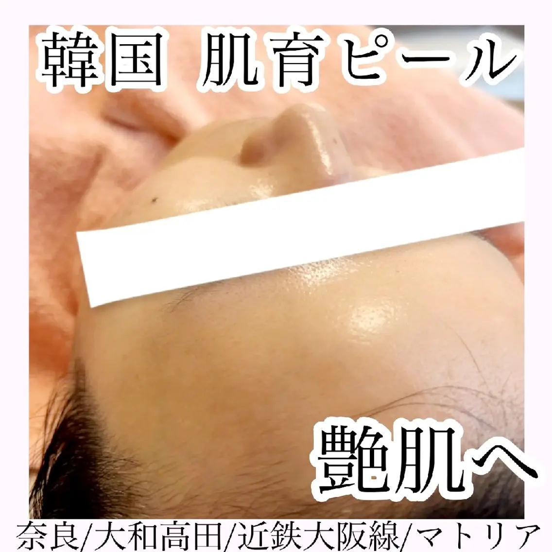 継続される方が続出!!! 韓国発ララピール!シワ、たるみ、ニキビ跡、毛穴、くすみ、などなどでお悩みの方にオススメの写真