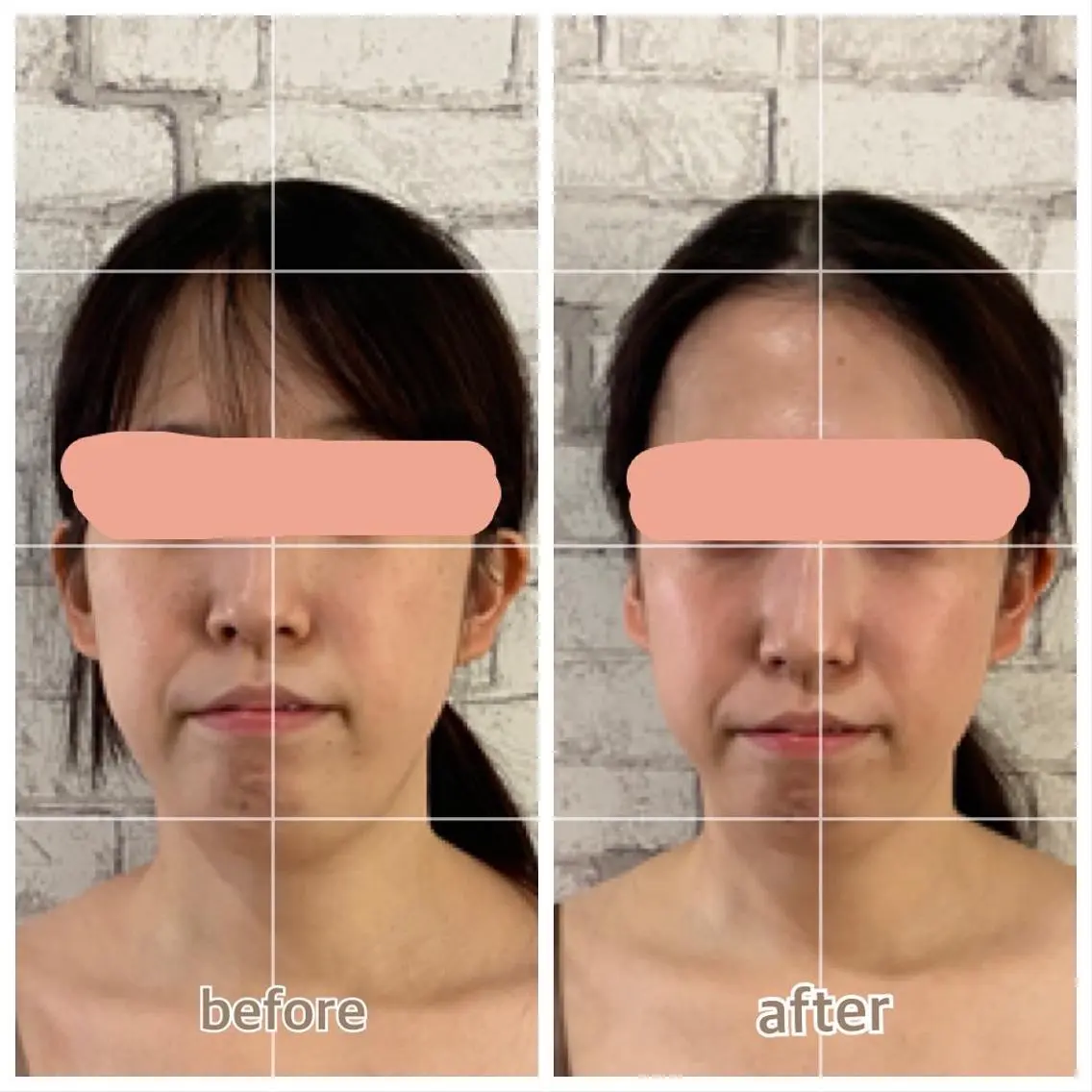 【小顔矯正フェイシャル】60分パック付きの写真