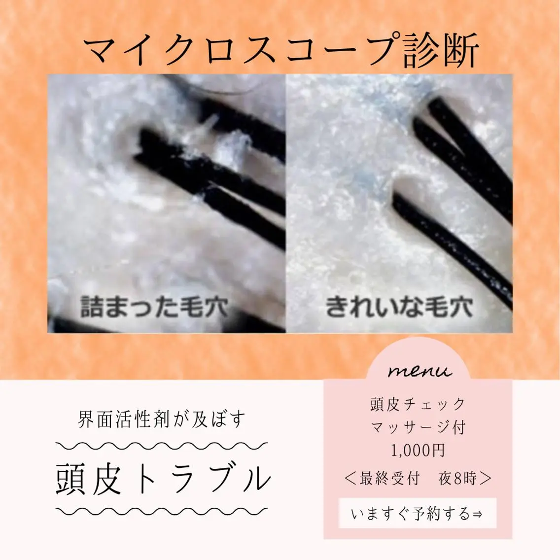 【髪・頭皮のお悩み】頭皮マイクロスコープ診断(頭皮マッサージ&マイクロスコープ込)の写真