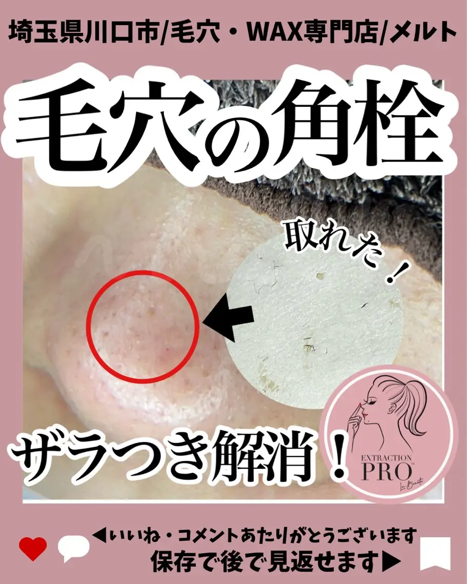 C. Lのマツエク・マツパデザイン