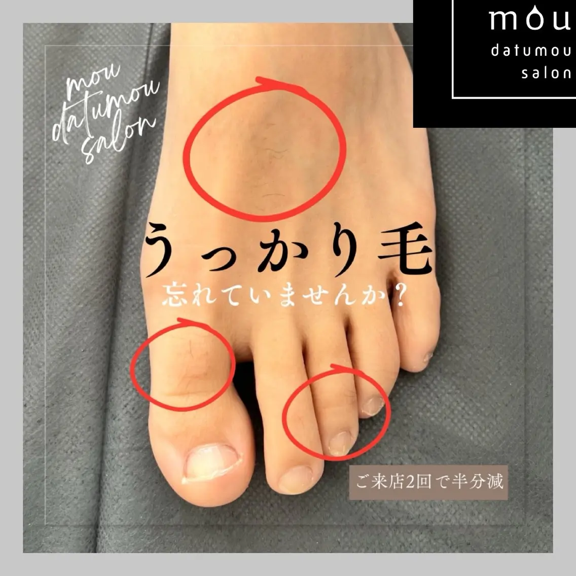 メンズ 脱毛 moudatumou salonのエステ・リラクイメージ