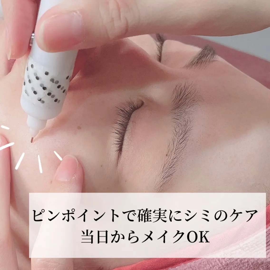 【シミケア10分お試し体験】結果出しの為のカウンセリング有次回ご予約で嬉しい特典付き♪の写真