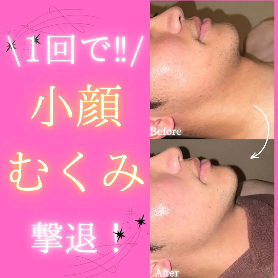 エステ 痩身&美肌サロン 堀米✨のその他イメージ