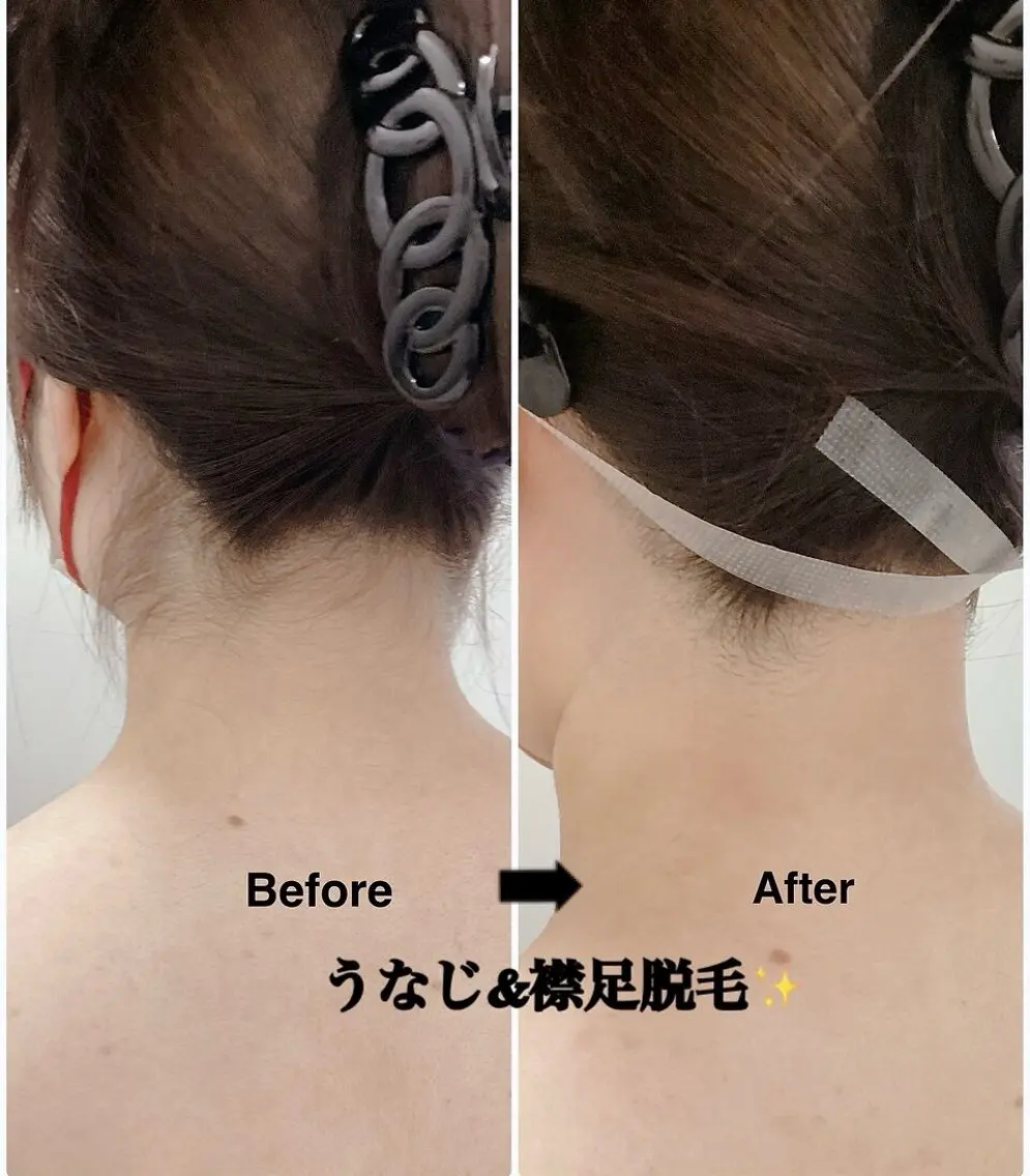 脱毛 韓国肌管理×毛穴 改善専門🤍nanaのエステ・リラクイメージ