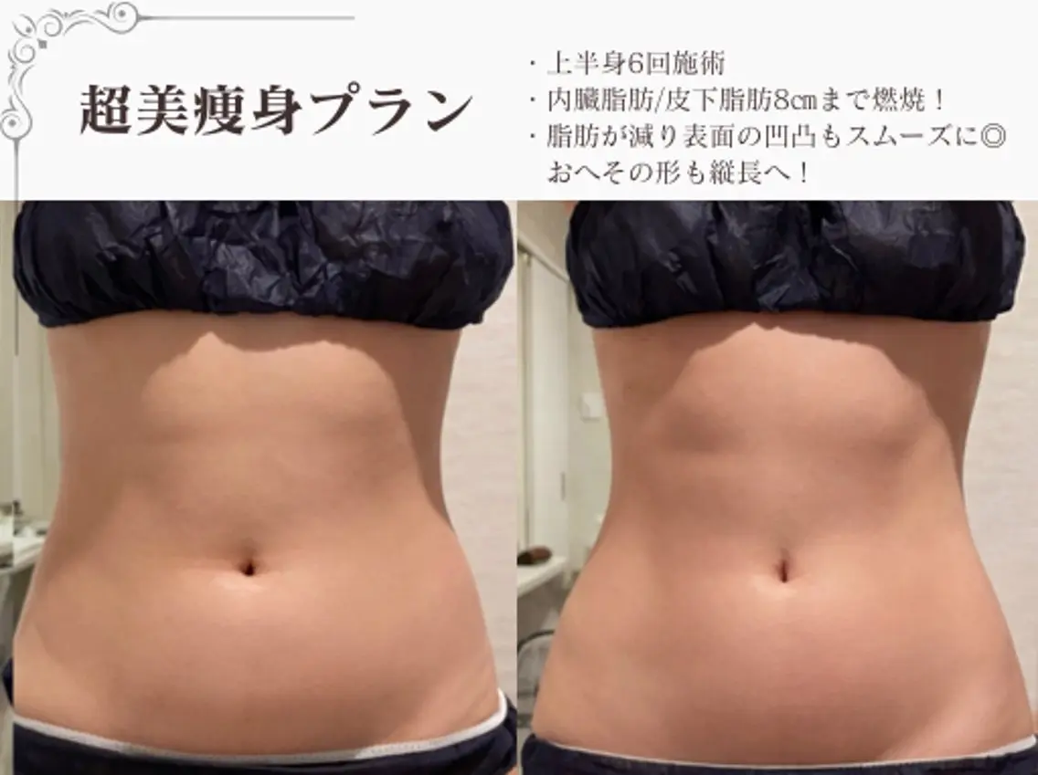 エステ リラク 総合美容サロン LOVEME渋谷本店のエステ・リラクイメージ