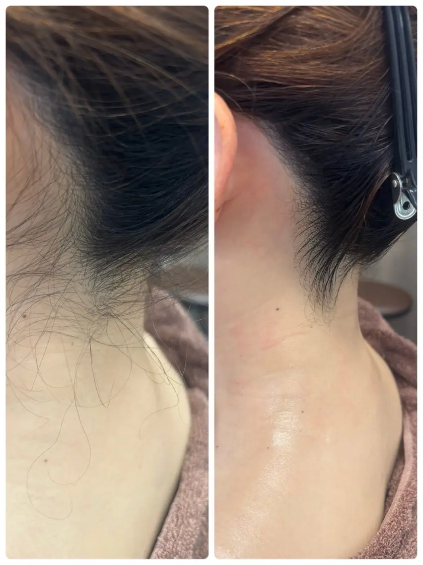 襟あし・うなじシェービングの写真