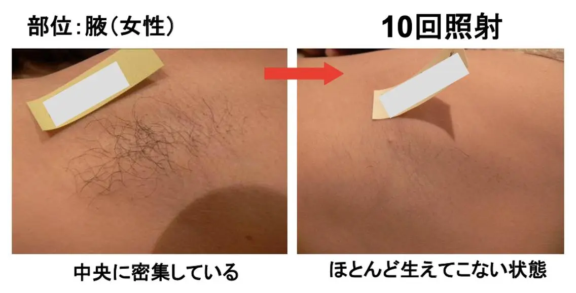 leolo武蔵浦和 肌質改善&脱毛のエステ・リラクイメージ
