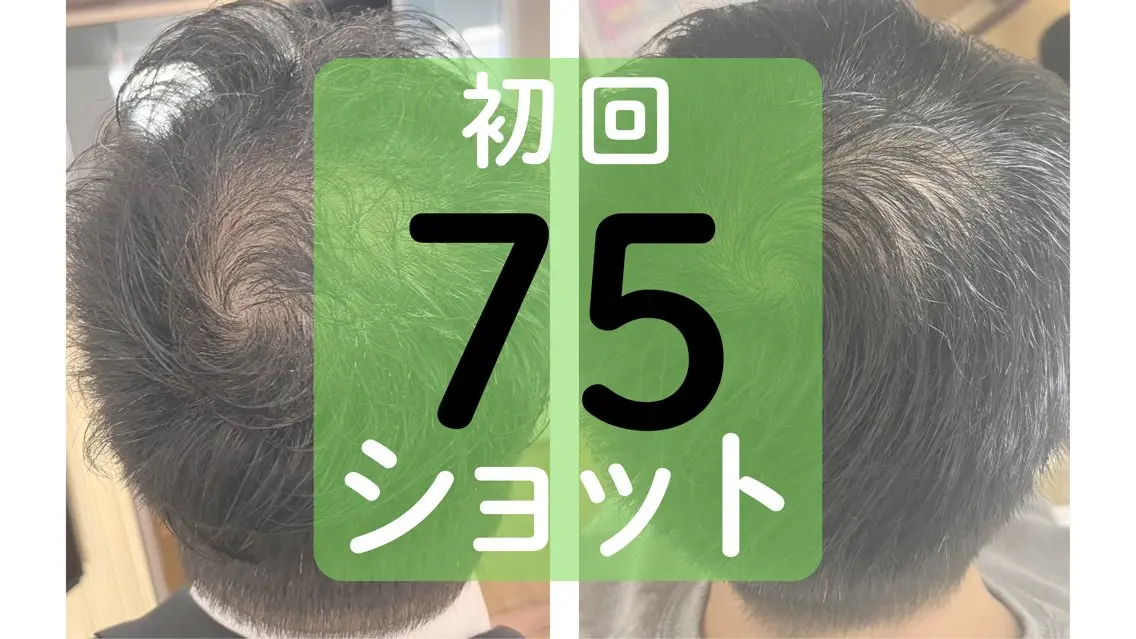 【初回価格】シワ・シミ・くすみ・たるみなどお顔全般のケアに 75ショットの写真