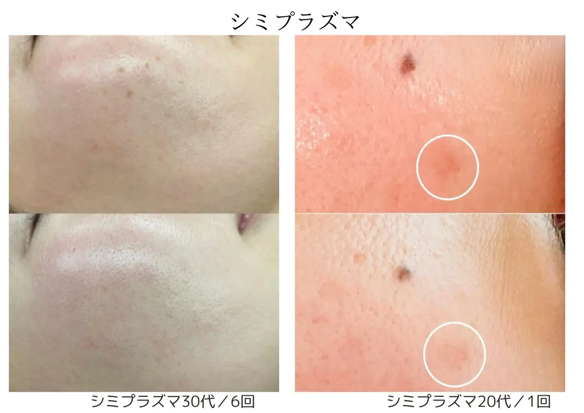 小顔＆肌質改善 NICORIのエステ・リラクイメージ