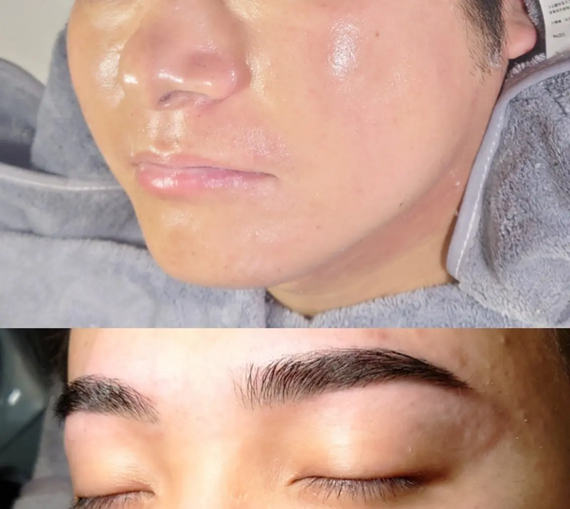 メンズ専門【眉毛HBL+お試し鼻毛穴洗浄】の写真