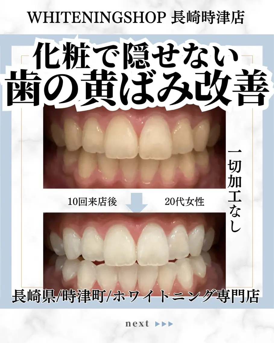 ホワイトニング ショップ長崎時津店のその他イメージ