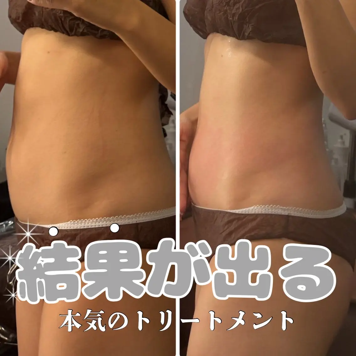 エステ DOUDOU ESTHEのその他イメージ