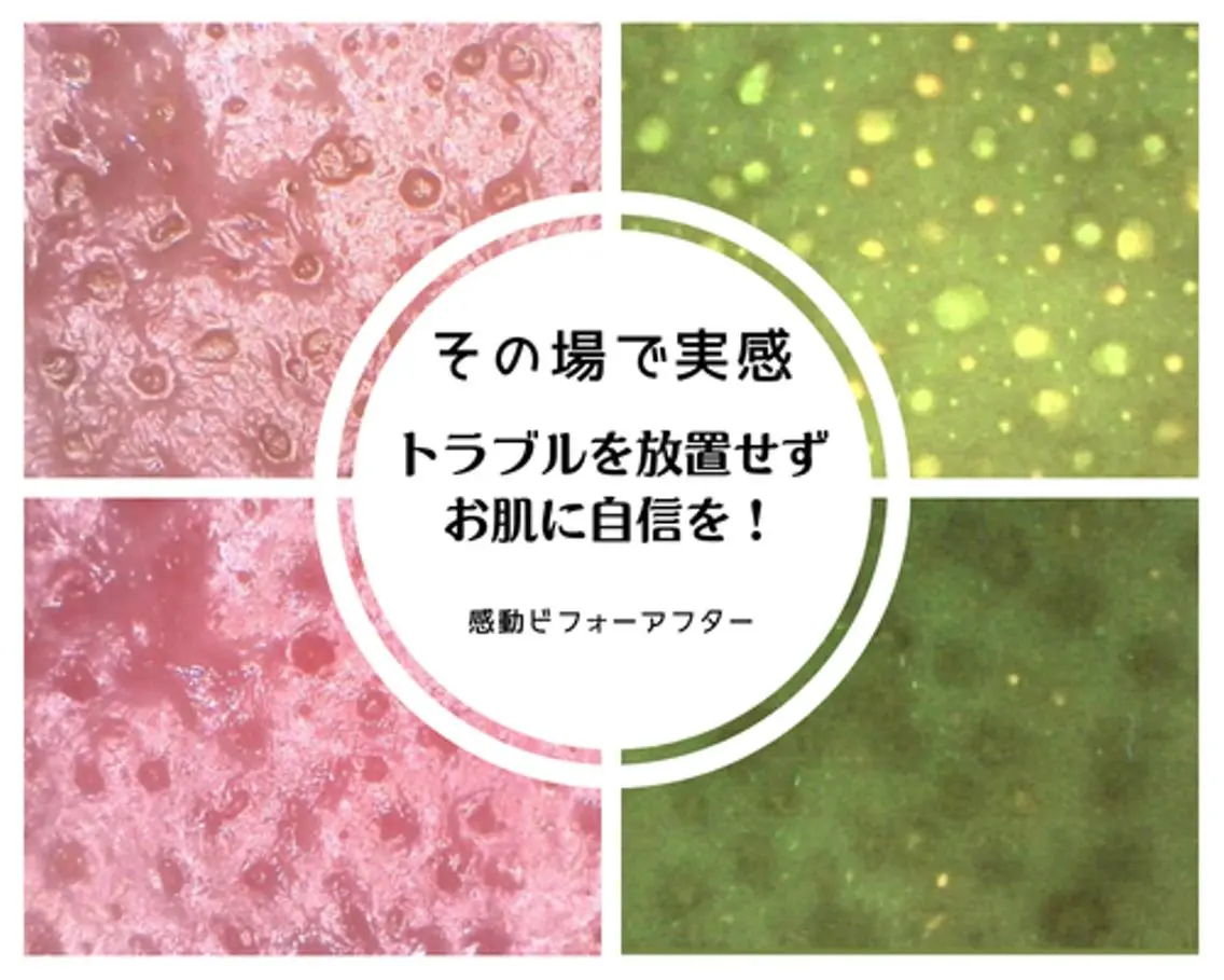 毛穴専門店Bébé 大阪中央店のエステ・リラクイメージ