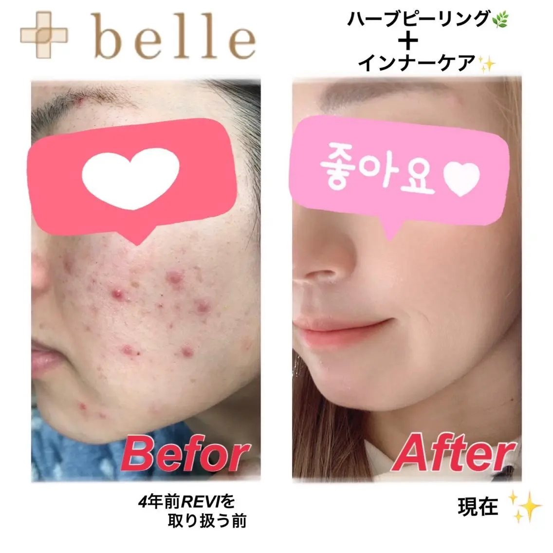メンズ +belle プリュベルのエステ・リラクイメージ