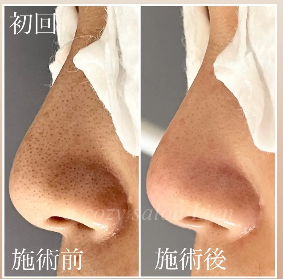 渡邊 しずかのエステ・リラクイメージ