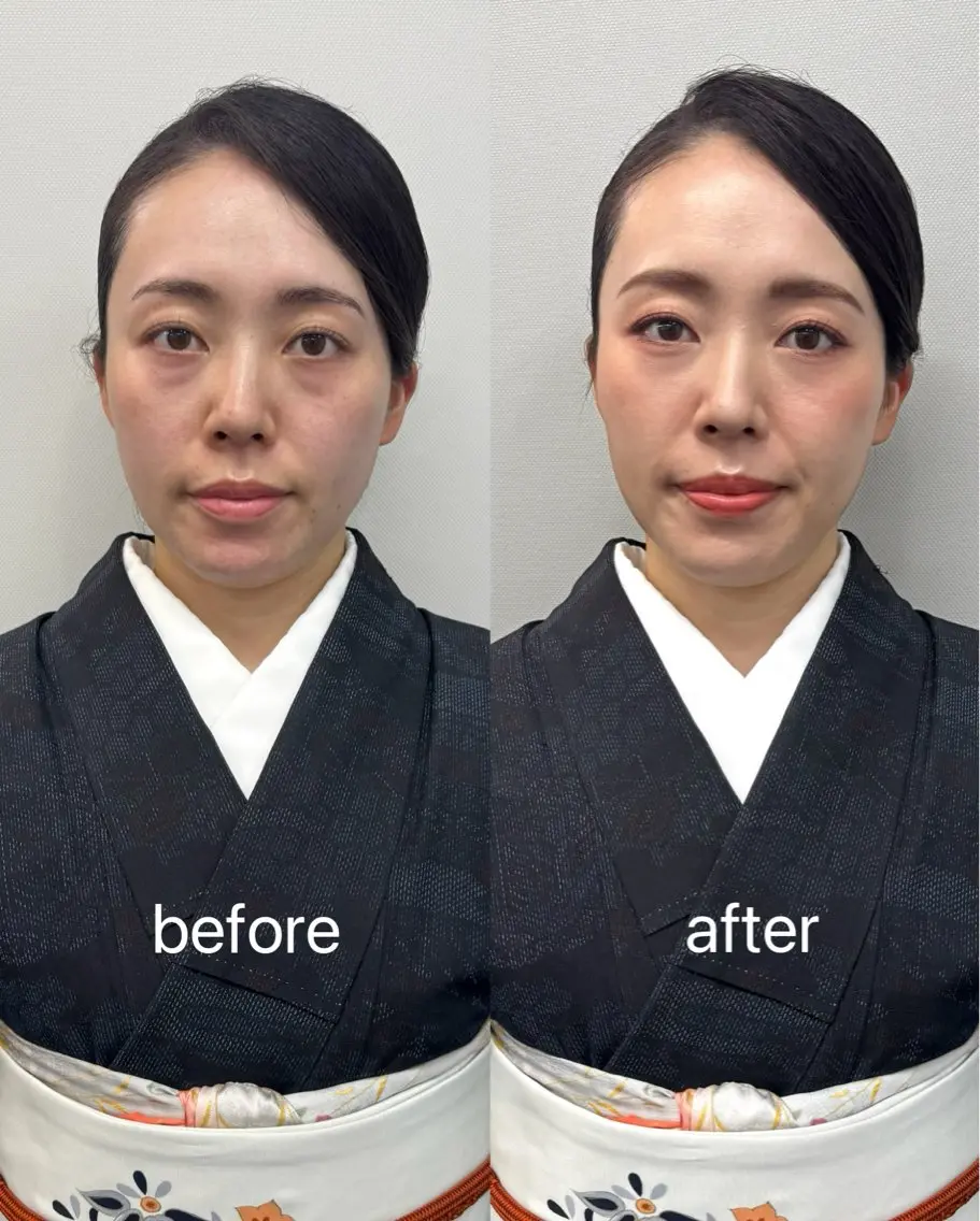 ヘアメイク naomiのその他イメージ