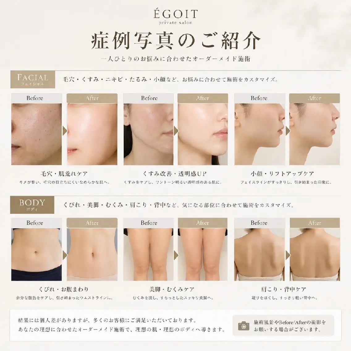 エステ リラク 恵比寿│本格肌質改善 ・韓国肌・小顔・痩身のエステ・リラクイメージ