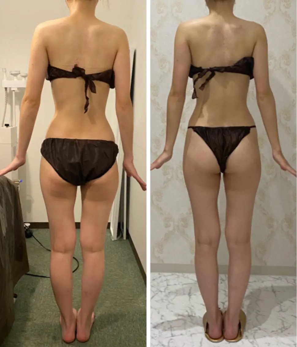 SLIMMOVE全身お試し90分の写真