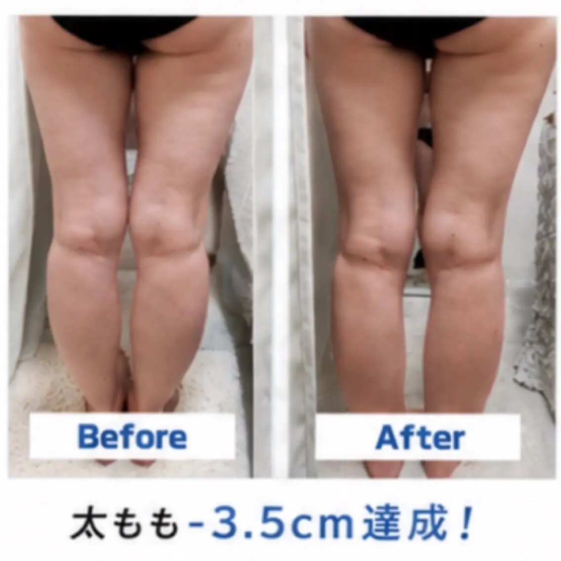 キャビテーション40分+下半身or上半身痩身エステ50分の写真