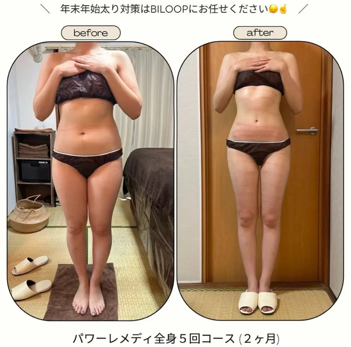 《本気痩せ×疲労改善 》  BILOOPのエステ・リラクイメージ