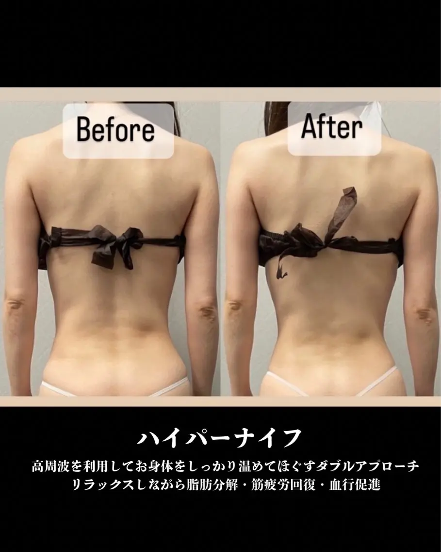 エステ D-Salon プライベートサロンのネイルデザイン